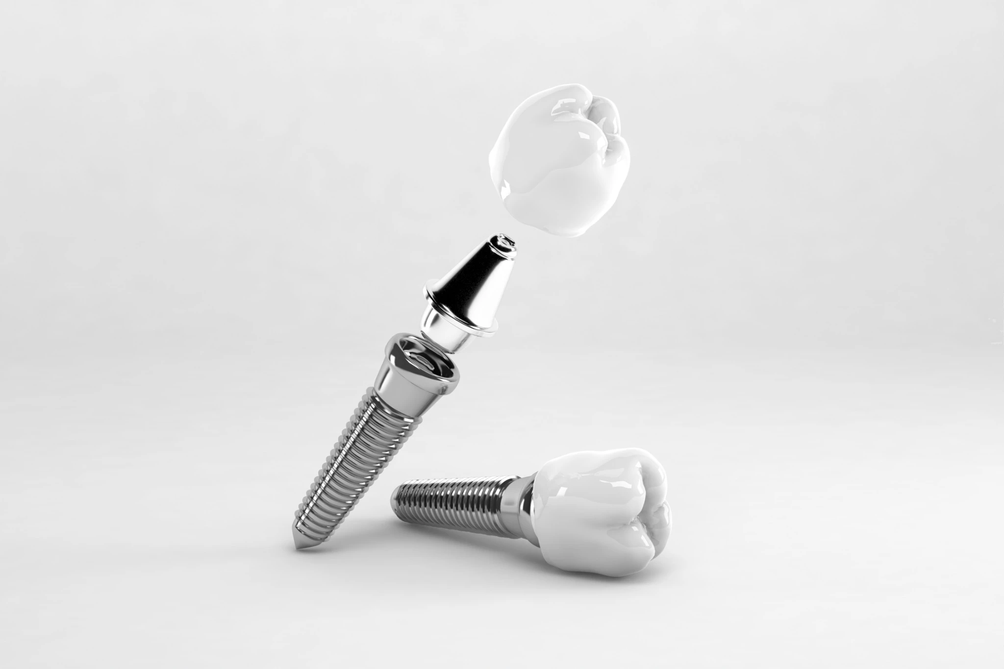 Illustrated 3D view of false tooth and implant