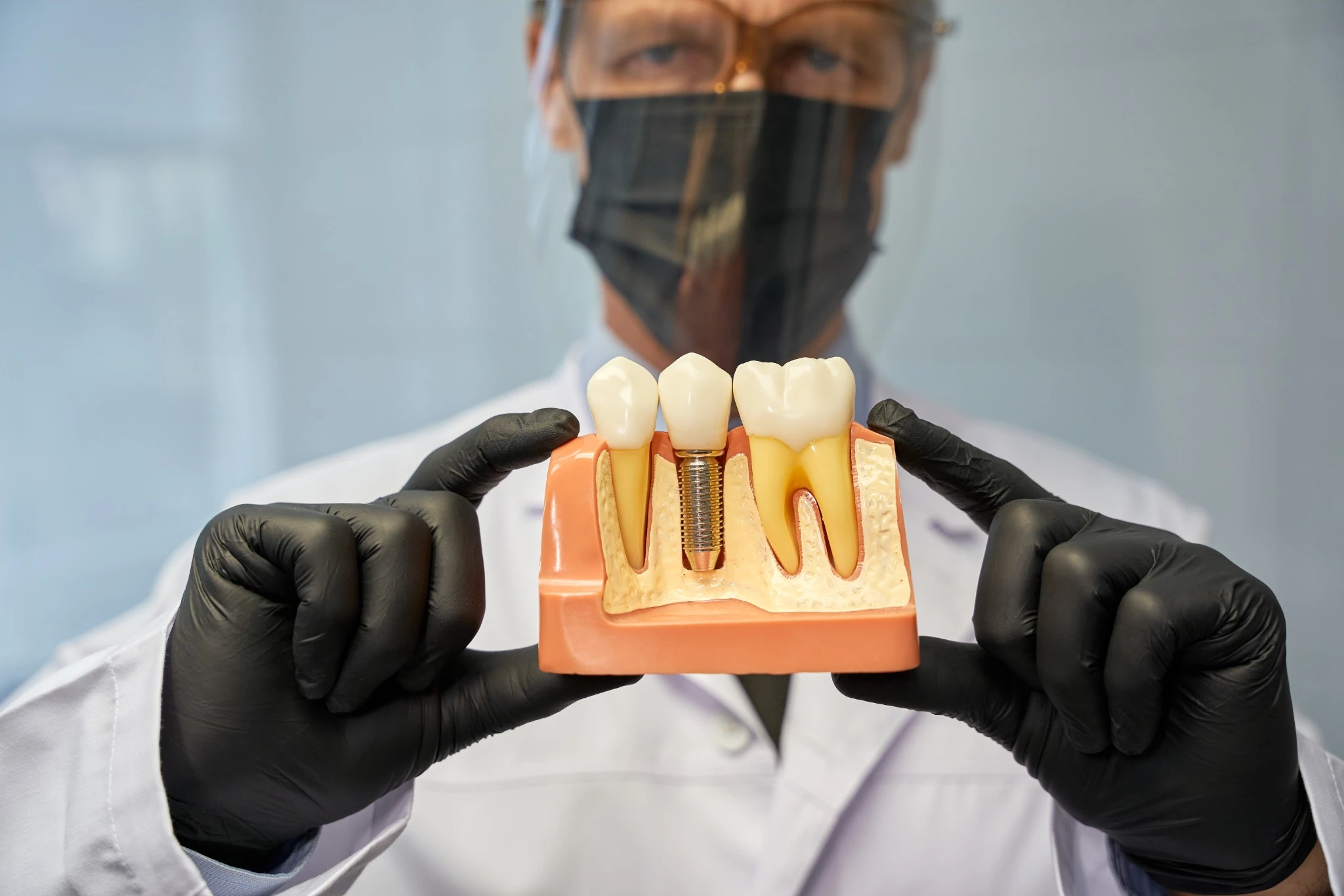 Close-up of dental implant model held by dentist